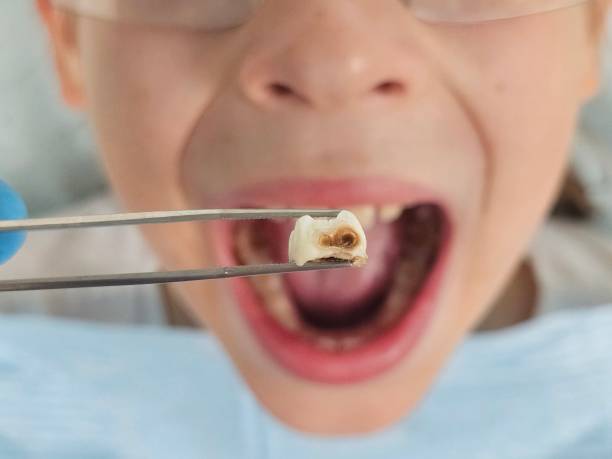 Best Emergency Gum Pain Relief  in Warren, OH